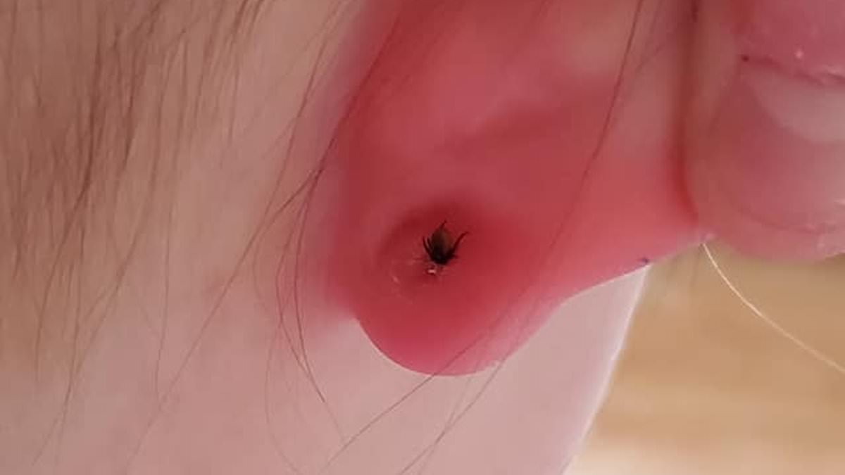 Featured image for "Disturbing Discovery on Child's Ear Sparks Urgent Warning to Parents"