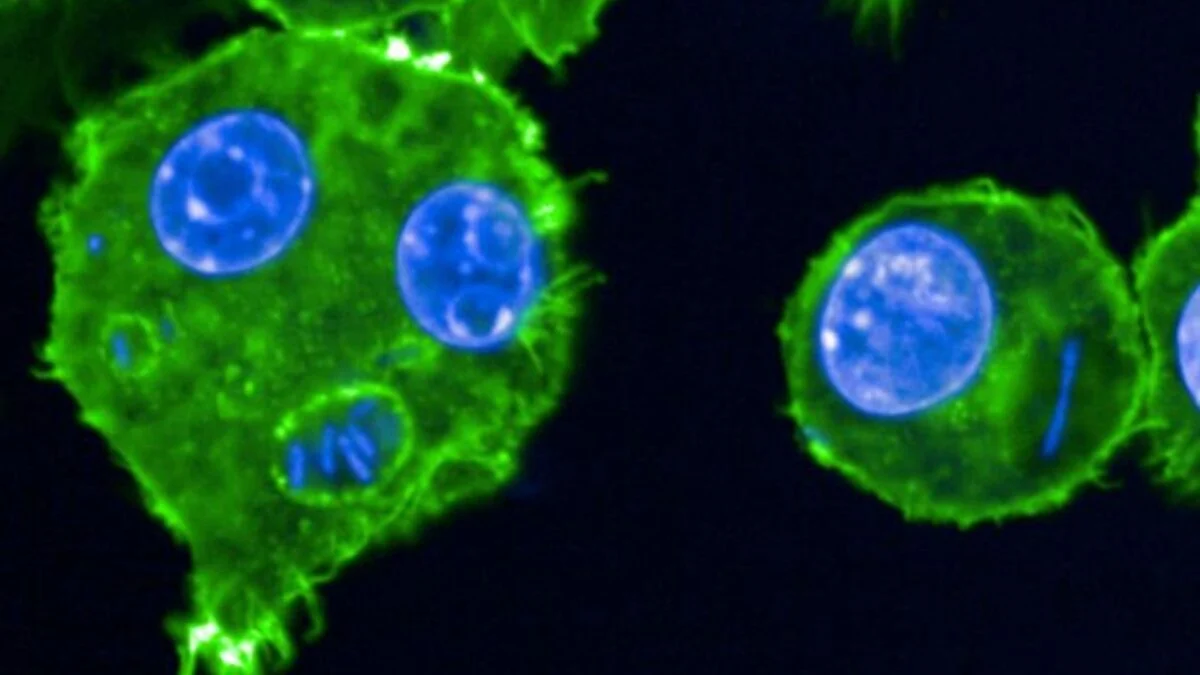 Featured image for Genetic Adaptation Enabled the Black Death's Long-Term Survival