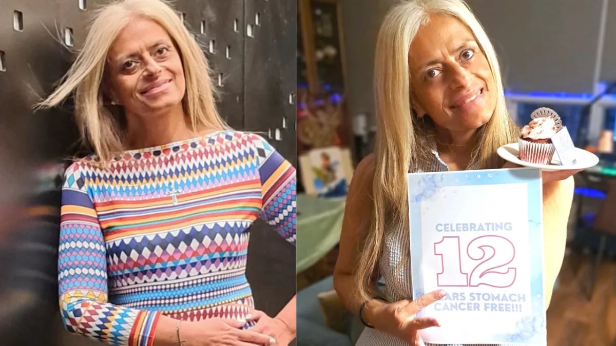 Featured image for "Surviving Stomach Cancer: Insights from a Patient Who Underwent 80% Stomach Removal"