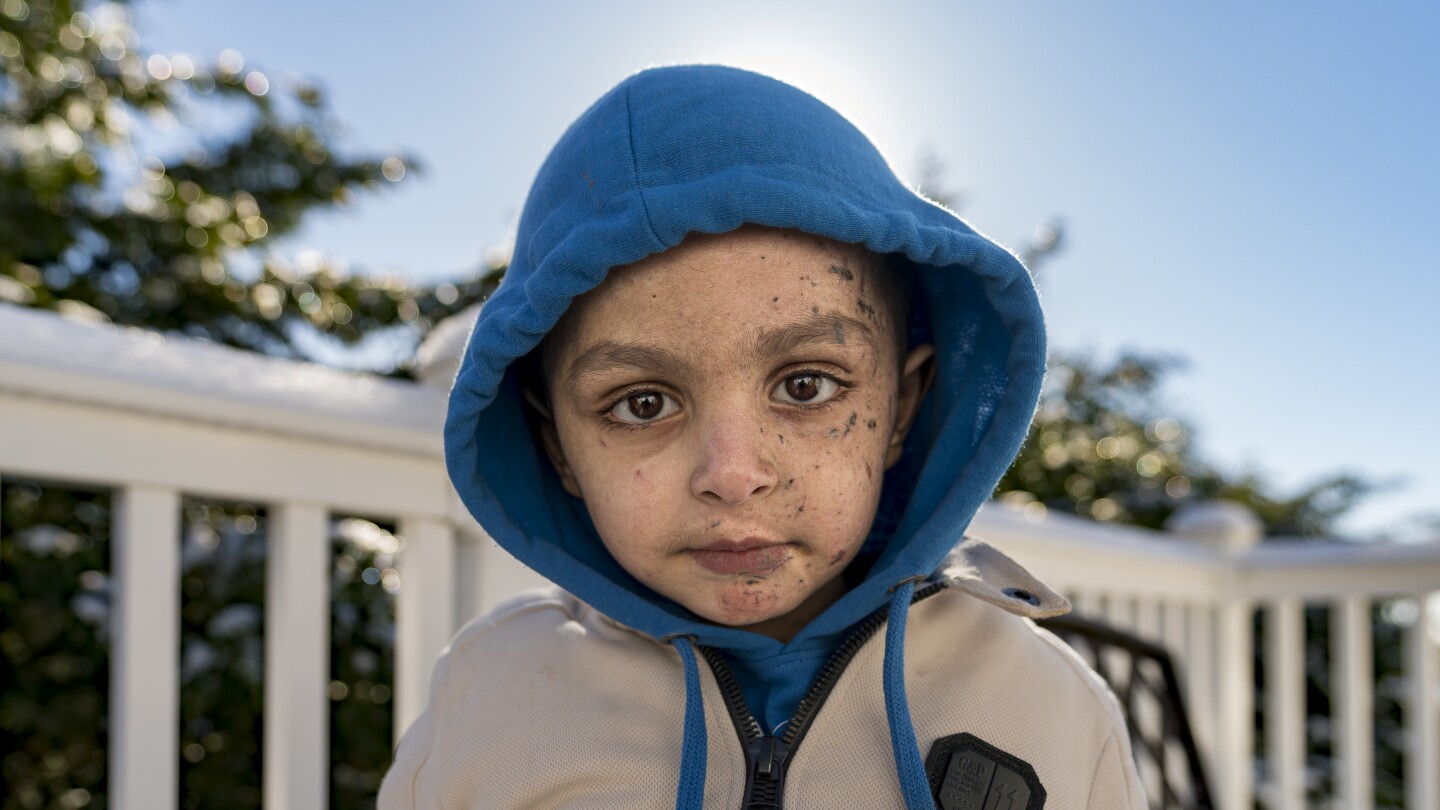 "4-Year-Old Gaza Boy Receives Second Chance Half a World Away"