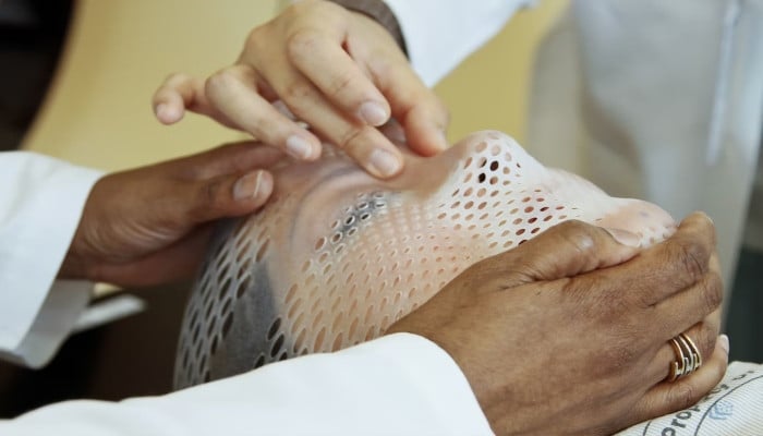 Featured image for Revolutionary wound dressings accelerate burn healing.