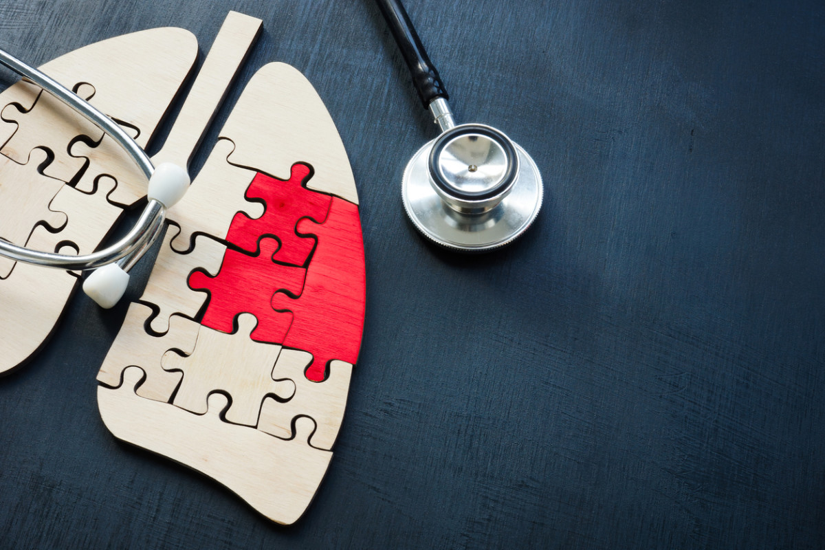 Featured image for Oncologists Reveal the Overlooked Early Sign of Lung Cancer