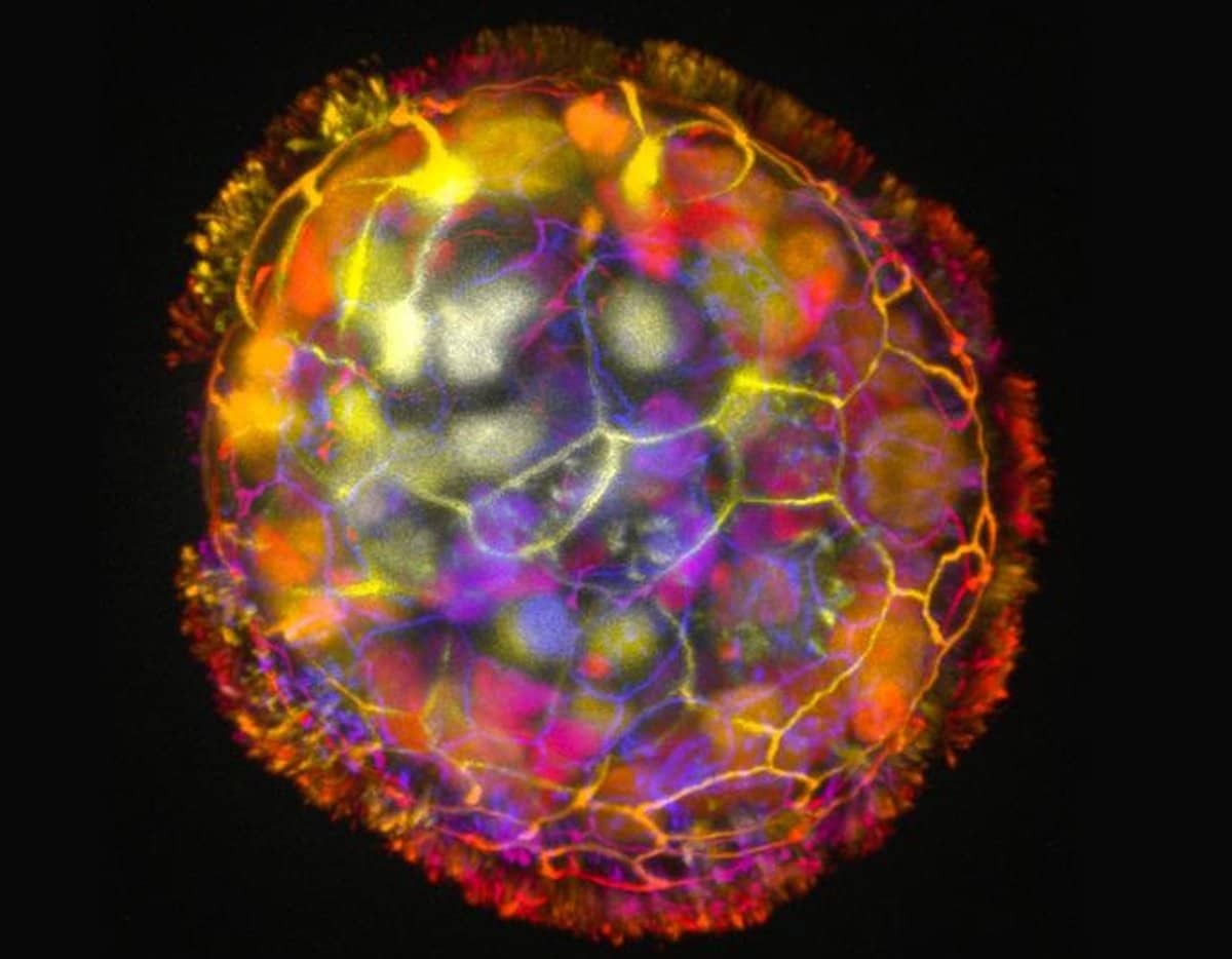 Featured image for "Anthrobots: Human Cell Biobots Heal Neurons"