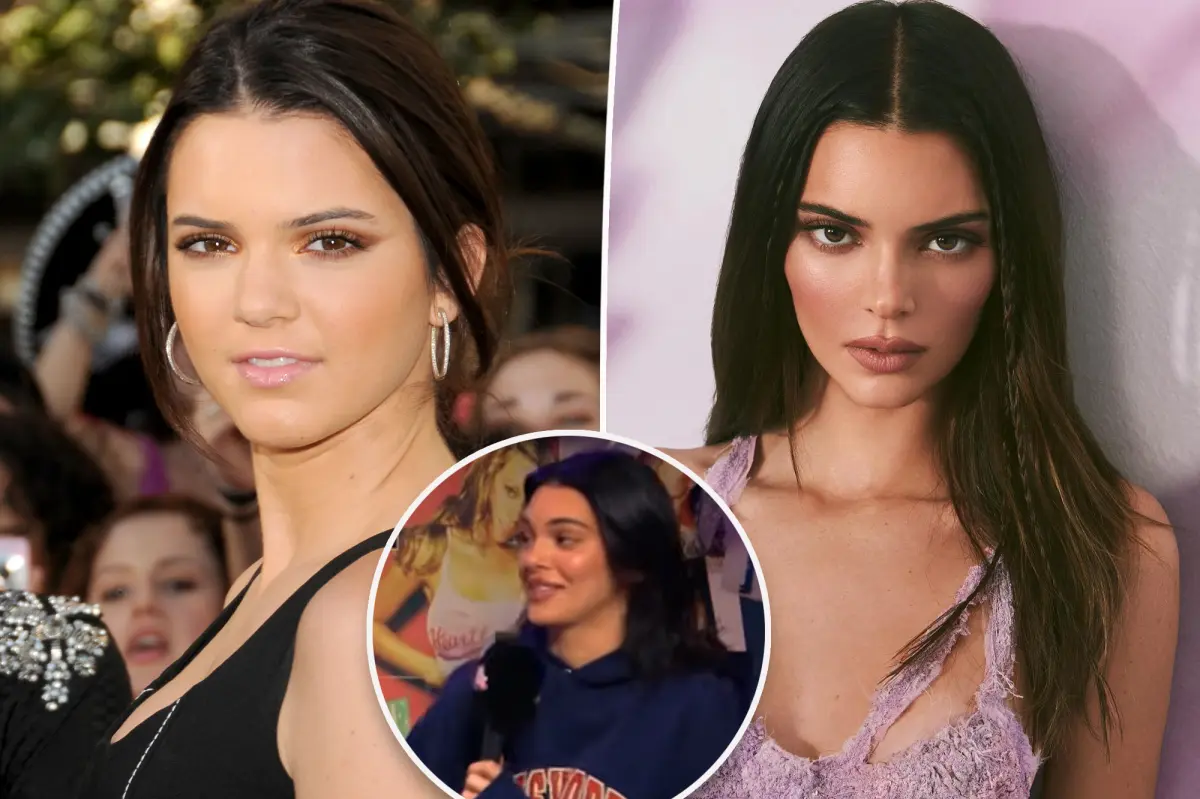 Featured image for Kendall Jenner Clarifies Her Cosmetic Procedures