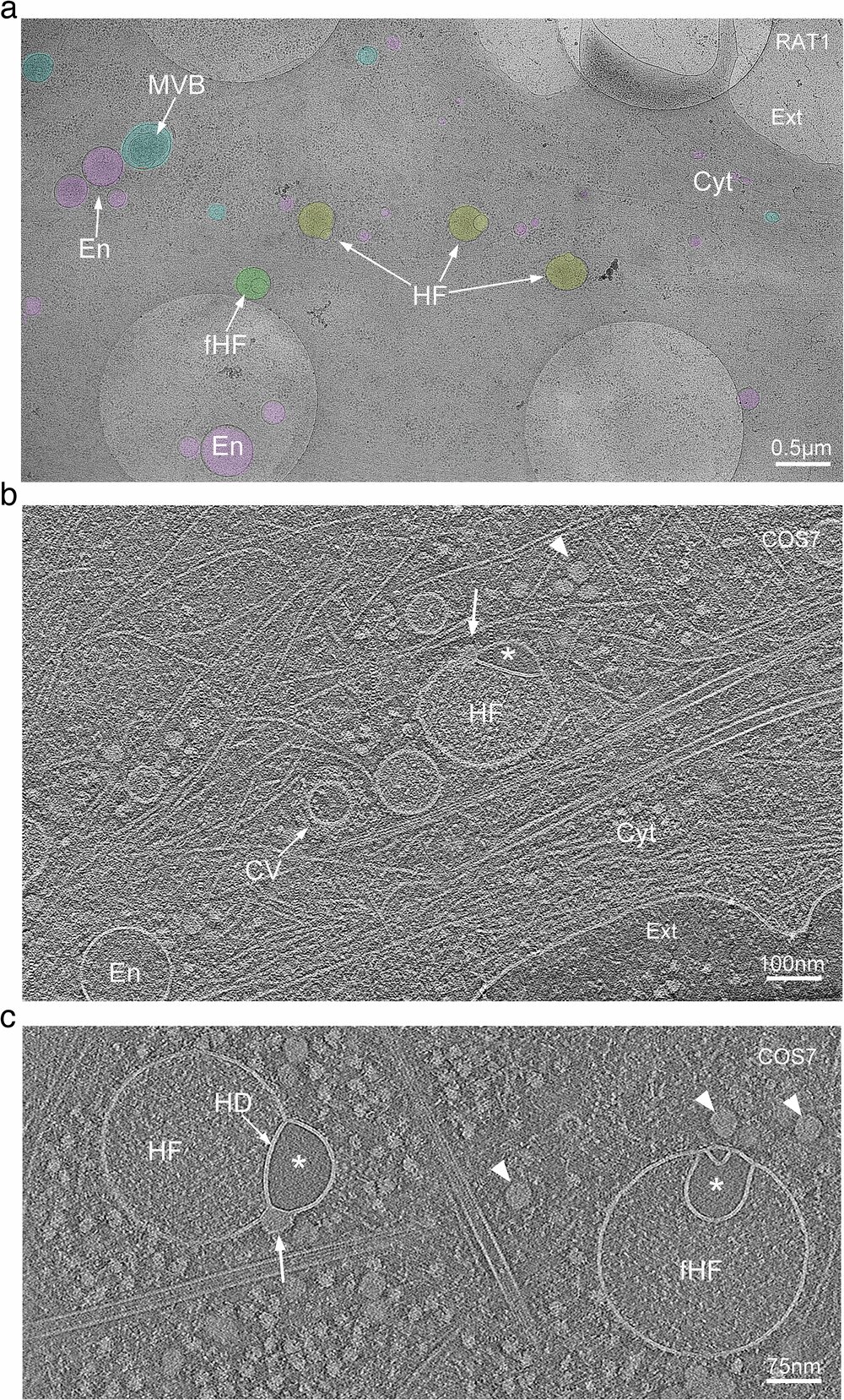 Featured image for Scientists Uncover New Organelle Within Human Cells