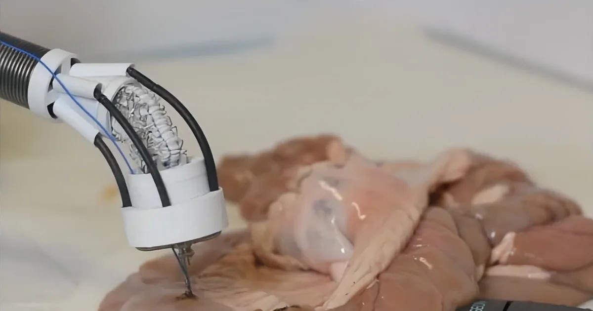 Featured image for Revolutionary 3D Bioprinter Repairs Tissue Damage from Within.