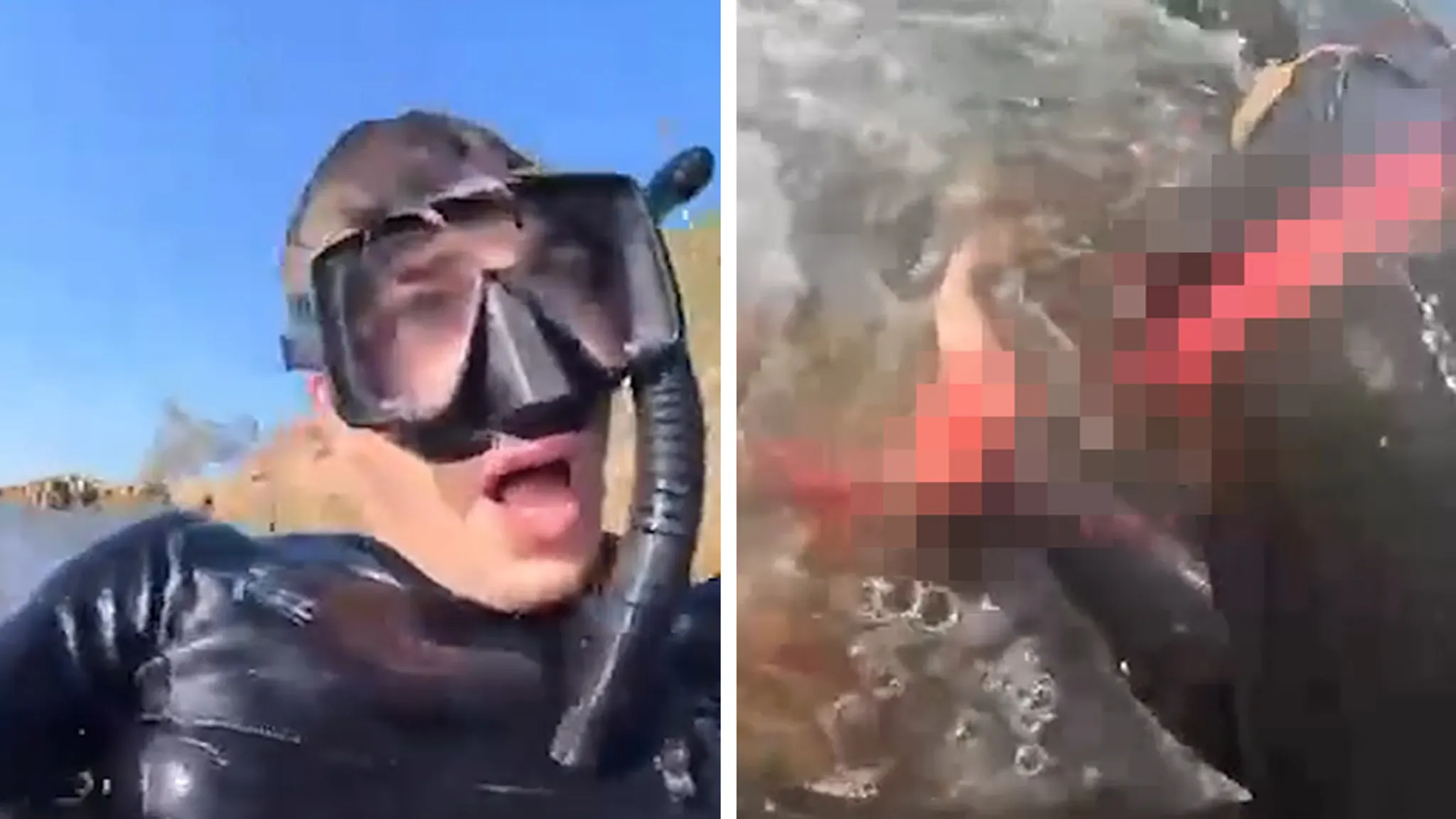 Survivor Shares Terrifying Video of Shark Attack That Took His Leg