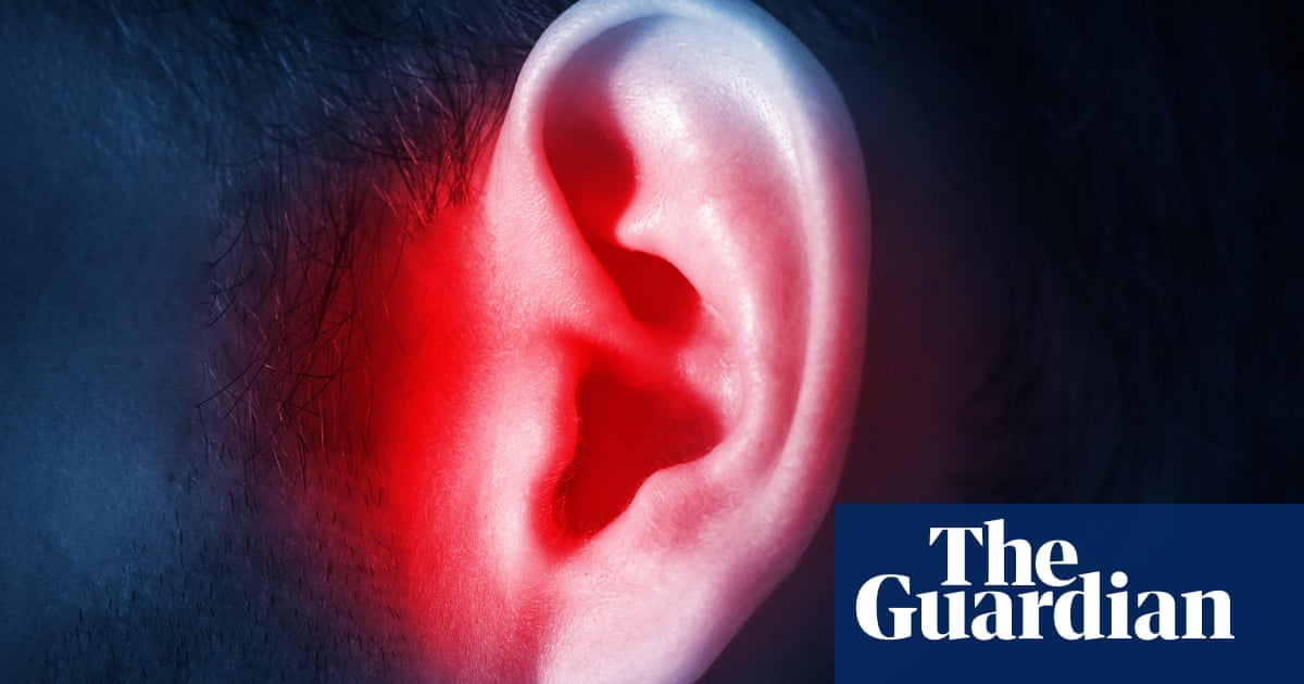 "Researchers Develop App to Alleviate Tinnitus Impact"