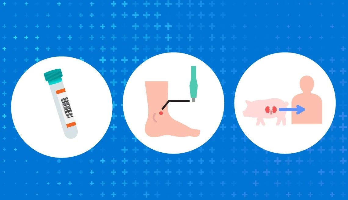 Featured image for "Gene-Edited Pig Kidney Transplant Marks Medical Breakthrough for Older Adults"