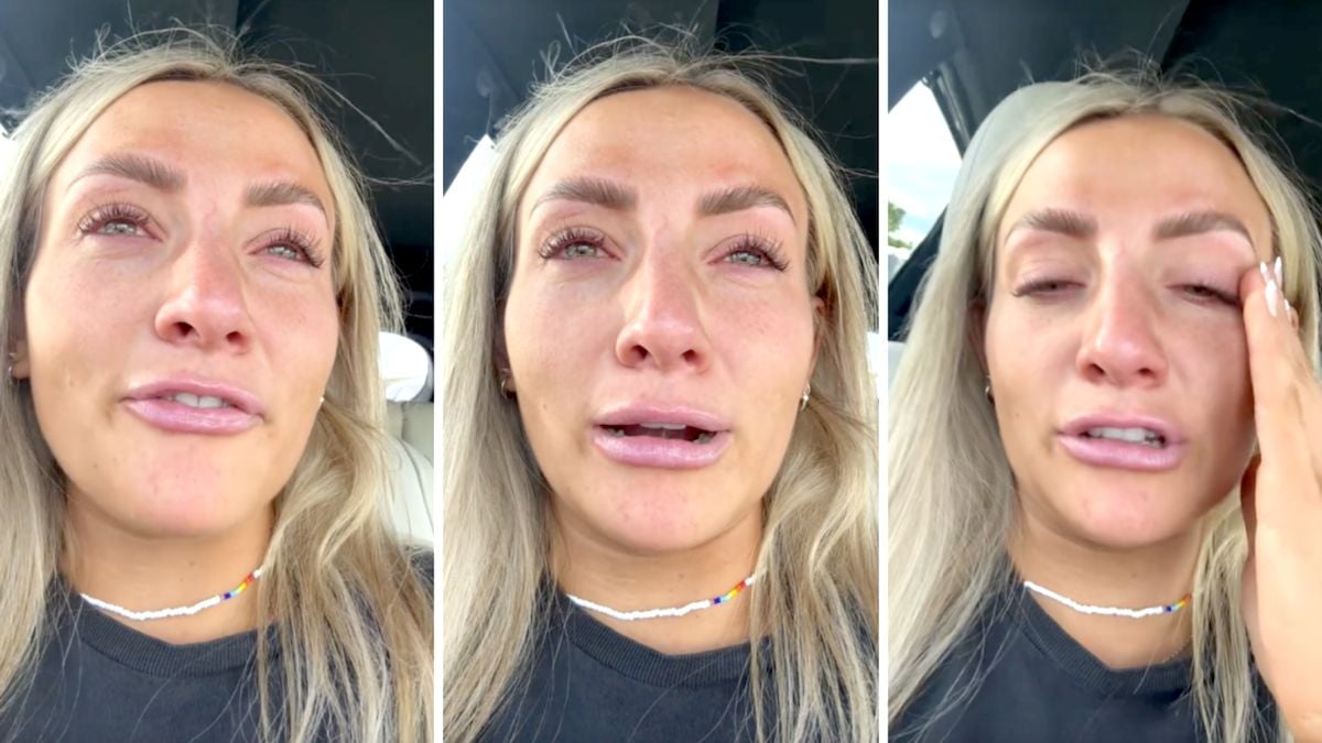 Featured image for Botox injections before wedding leave bride in tears as smile is 'ruined'