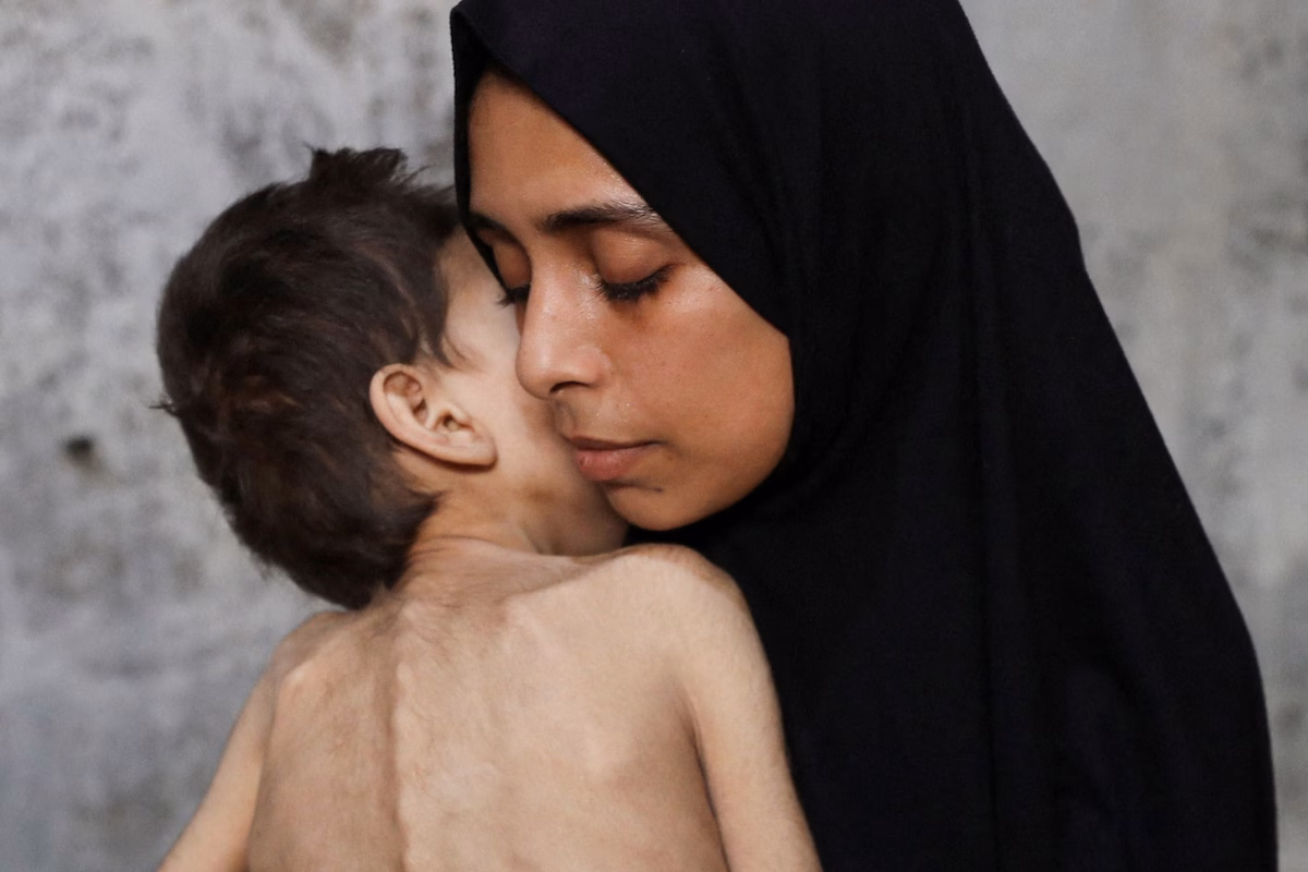 Featured image for Gaza's Hunger Crisis: The Human Toll and Aid Challenges