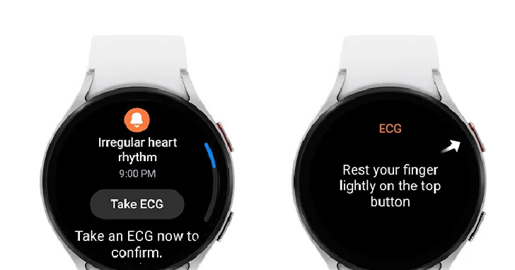 Featured image for Samsung's Galaxy Watch to Include Irregular Heart Rhythm Detection in Upcoming Update