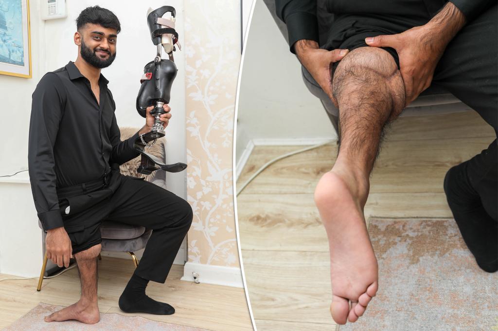 Featured image for Foot Sewn on Backward Saves Life After Amputation Due to Bone Cancer