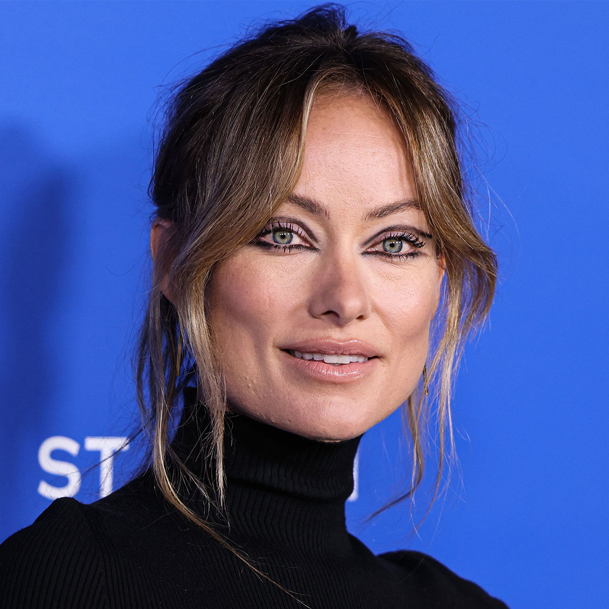 Olivia Wilde's Fans Speculate About Fat Removal Surgery After Social Media Photos