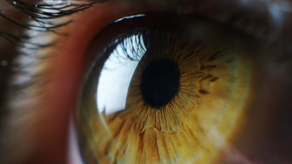 Featured image for Apellis Eye Drug Safety Review Reveals Link to Rare Blindness Cases