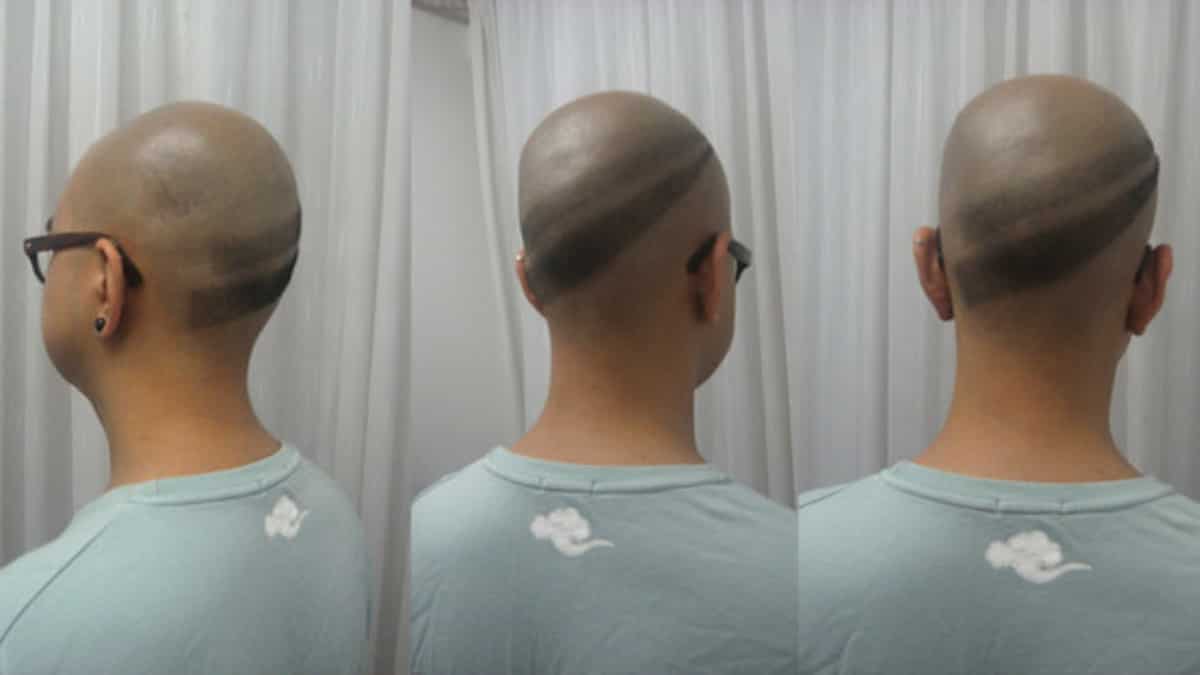 Featured image for "Breakthrough Discovery: Scientists Make Strides Towards a Hair-Loss Cure"
