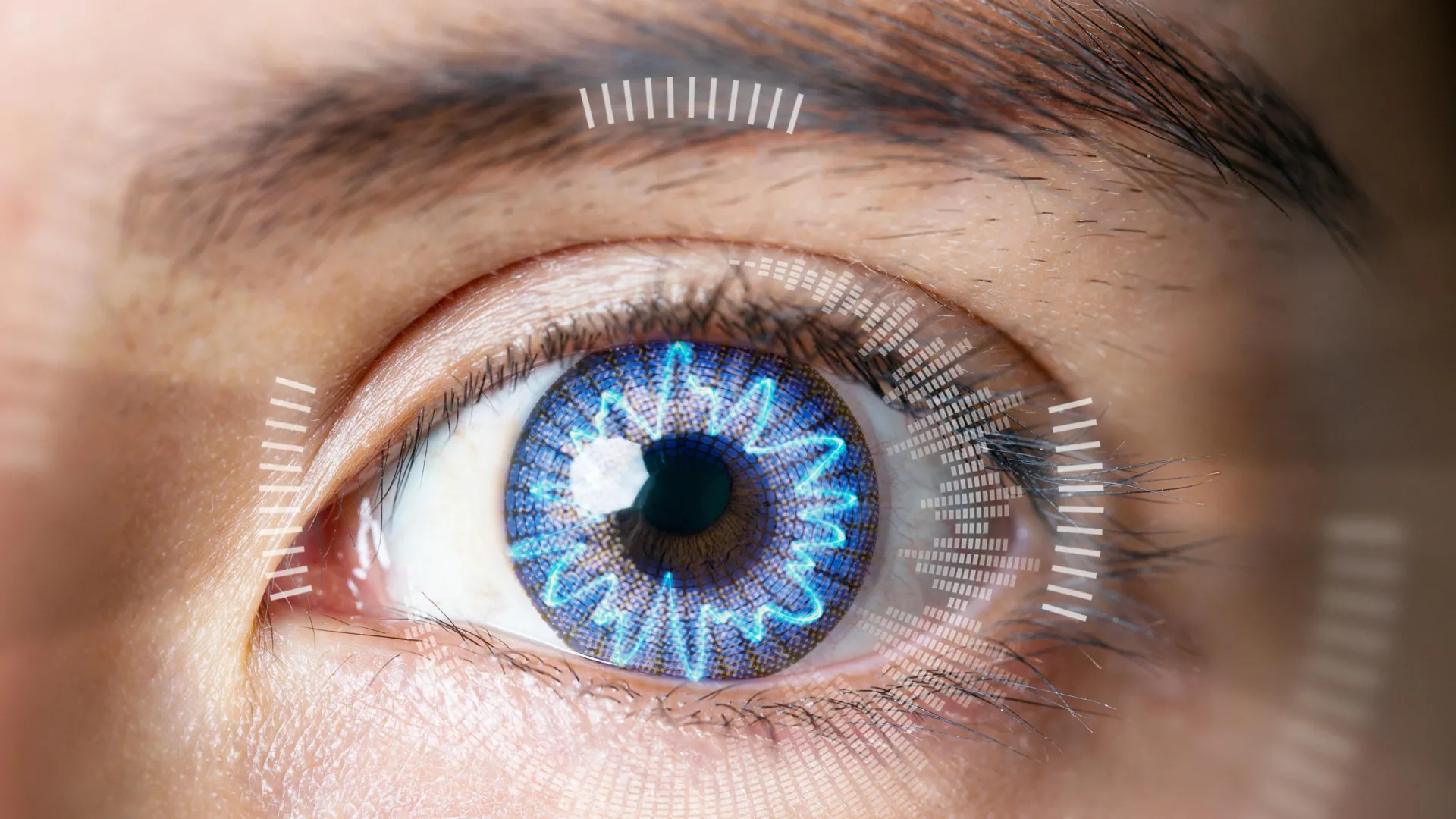 Featured image for New, Affordable Vision Correction May Replace LASIK
