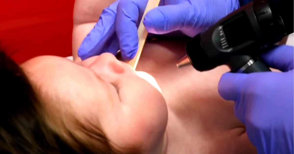 RSV Shot Demand Surges, Straining National Supply and Raising Safety Concerns