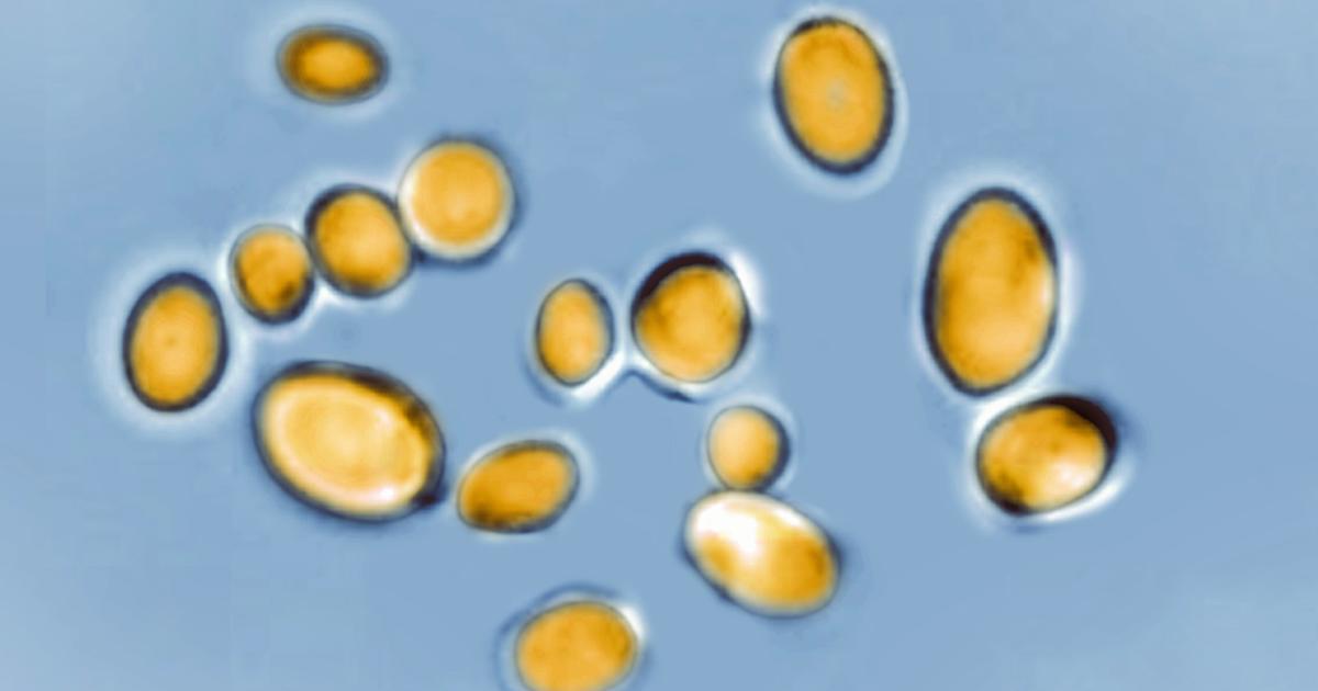 Featured image for Climate Change Linked to Rise of Dangerous Fungus Candida Auris