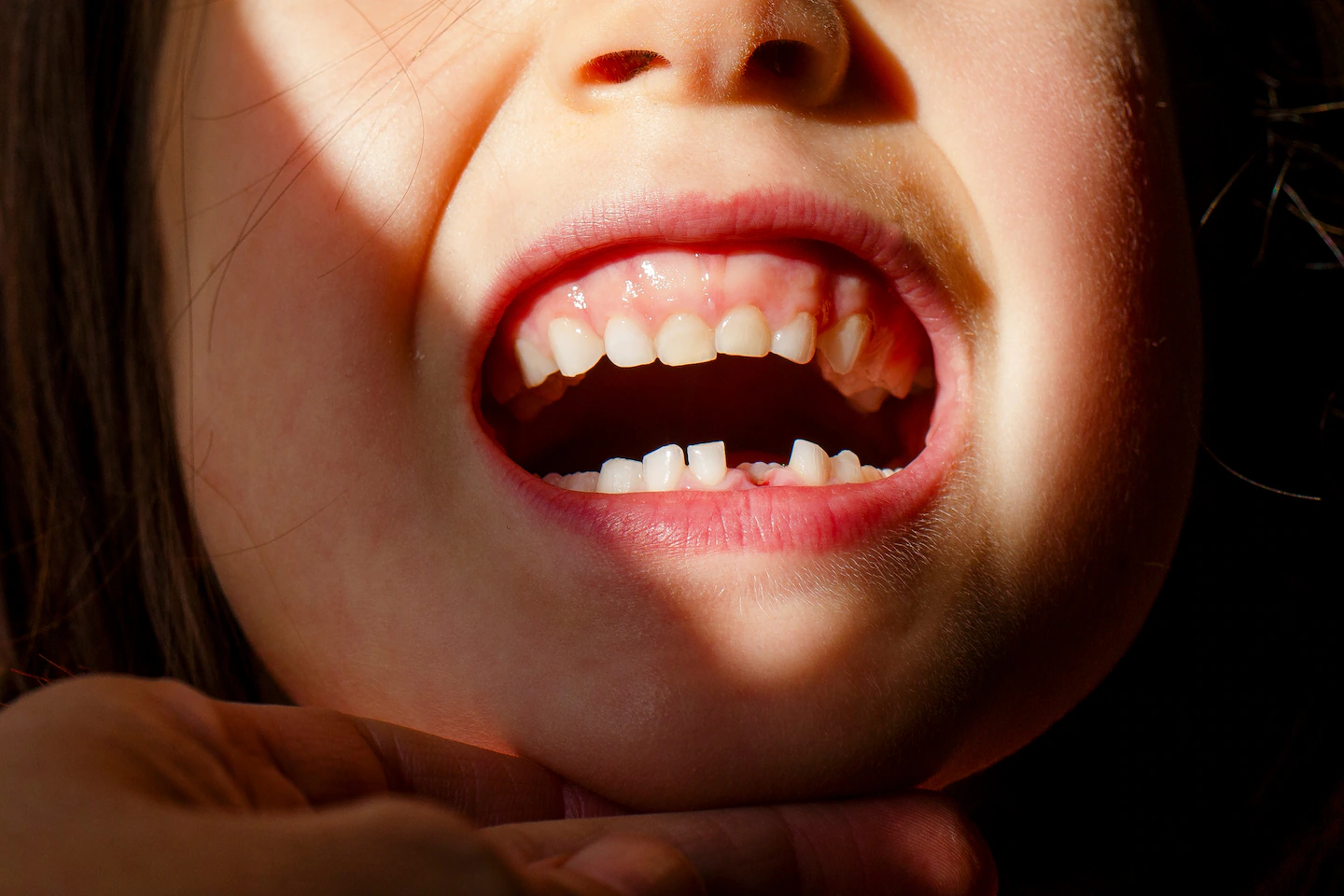 Featured image for FDA restricts fluoride supplements for children amid health concerns
