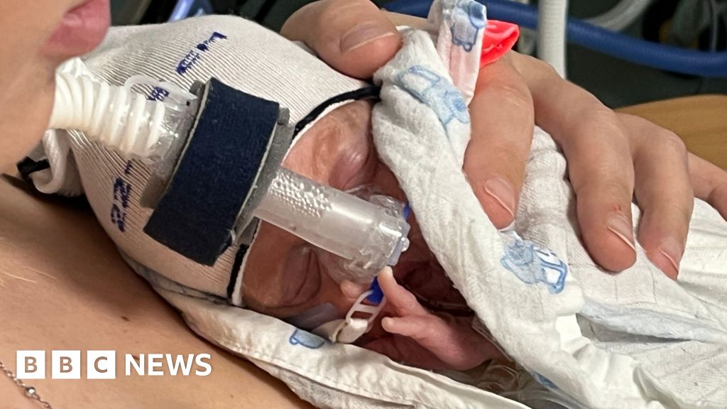 Featured image for Miracle Babies: The Fight for Survival at 22 Weeks