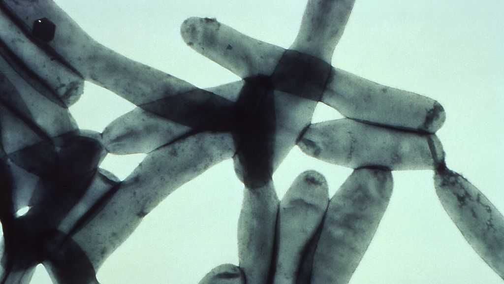 Featured image for Legionnaires' Disease Confirmed at Fort Smith Nursing Home