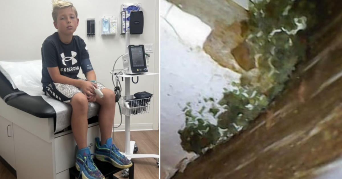 Featured image for "Mold Nightmare: Family Blames Santa Clara Home for Illness"