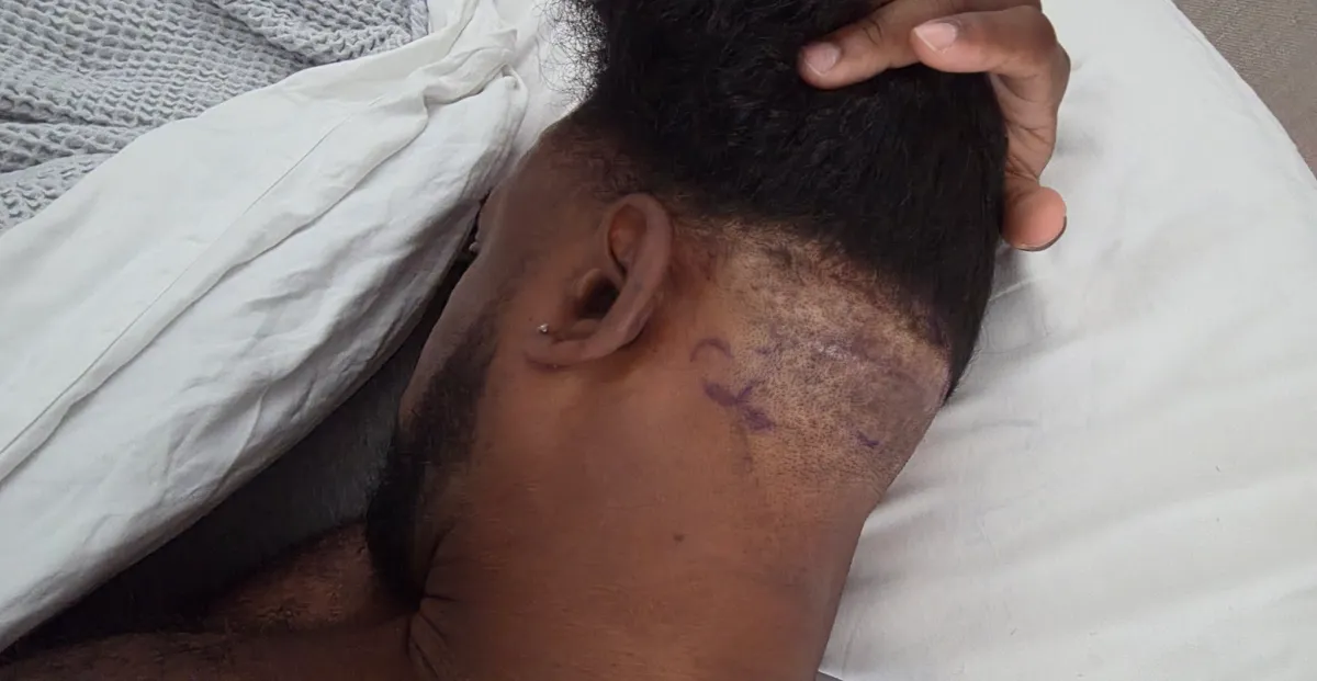 Featured image for Xavier Woods Undergoes Head Surgery and Shares Post-Op Photos