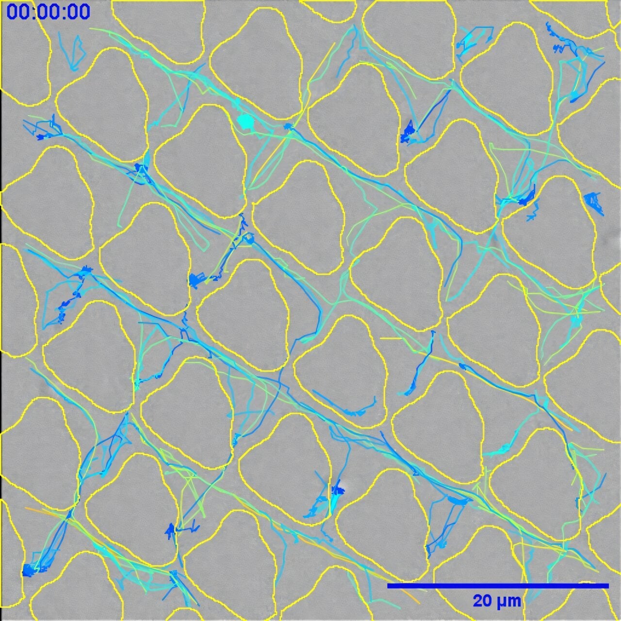 Featured image for Innovative Surface Patterns on Plastics Prevent Bacterial Infections