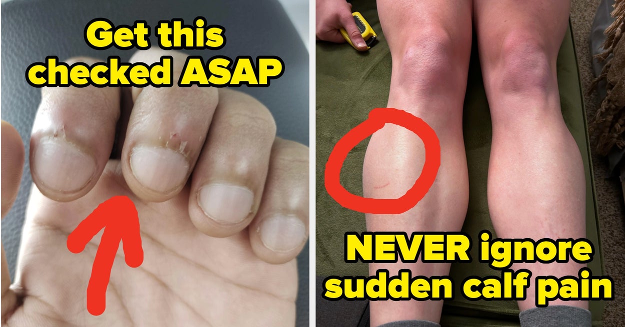 Featured image for Healthcare Professionals Warn of Small Health Signs That Could Be Serious