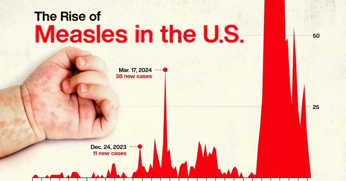 U.S. Faces Rising Measles Cases Threatening Public Health Gains