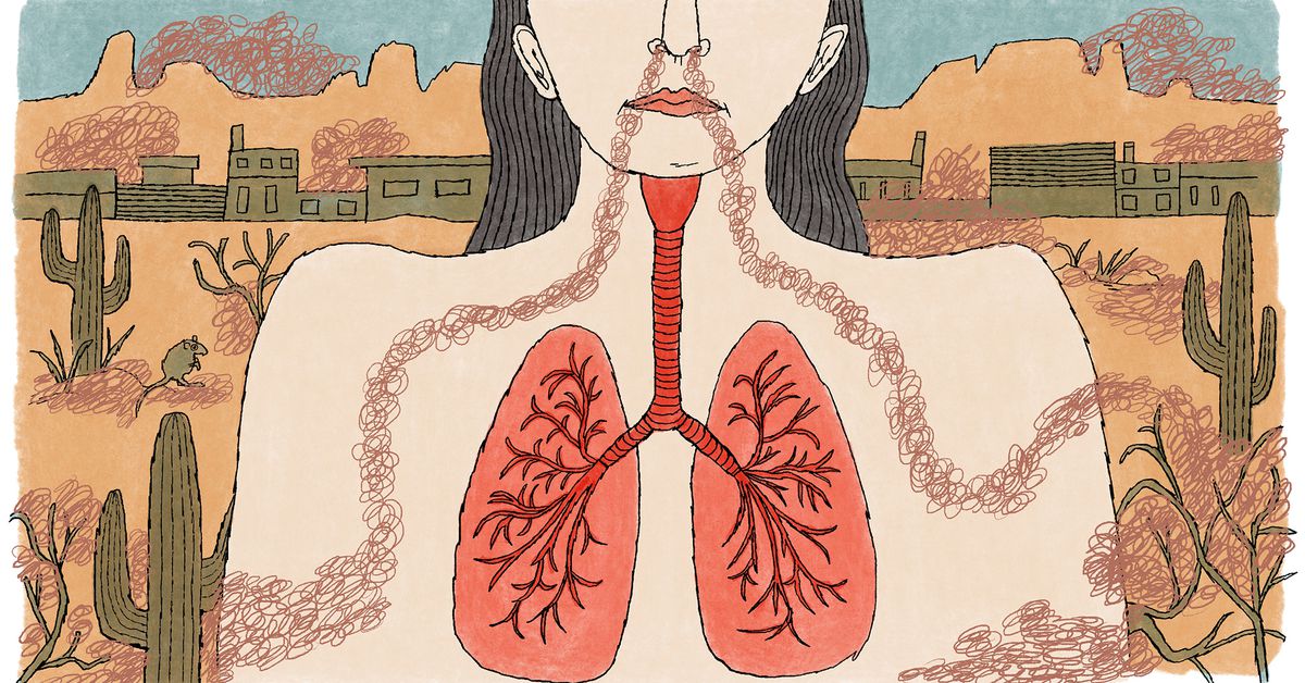 Featured image for Valley Fever on the Rise Due to Climate Change-Induced Fungal Infections