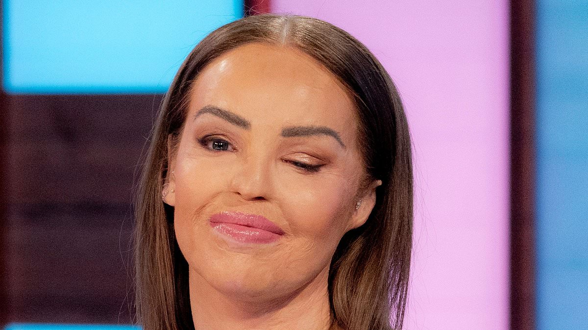 Featured image for "Katie Piper Donates £1,000 to Support Acid Attack Victim's Mother as London Chemical Attacker Abdul Ezedi Presumed Dead"