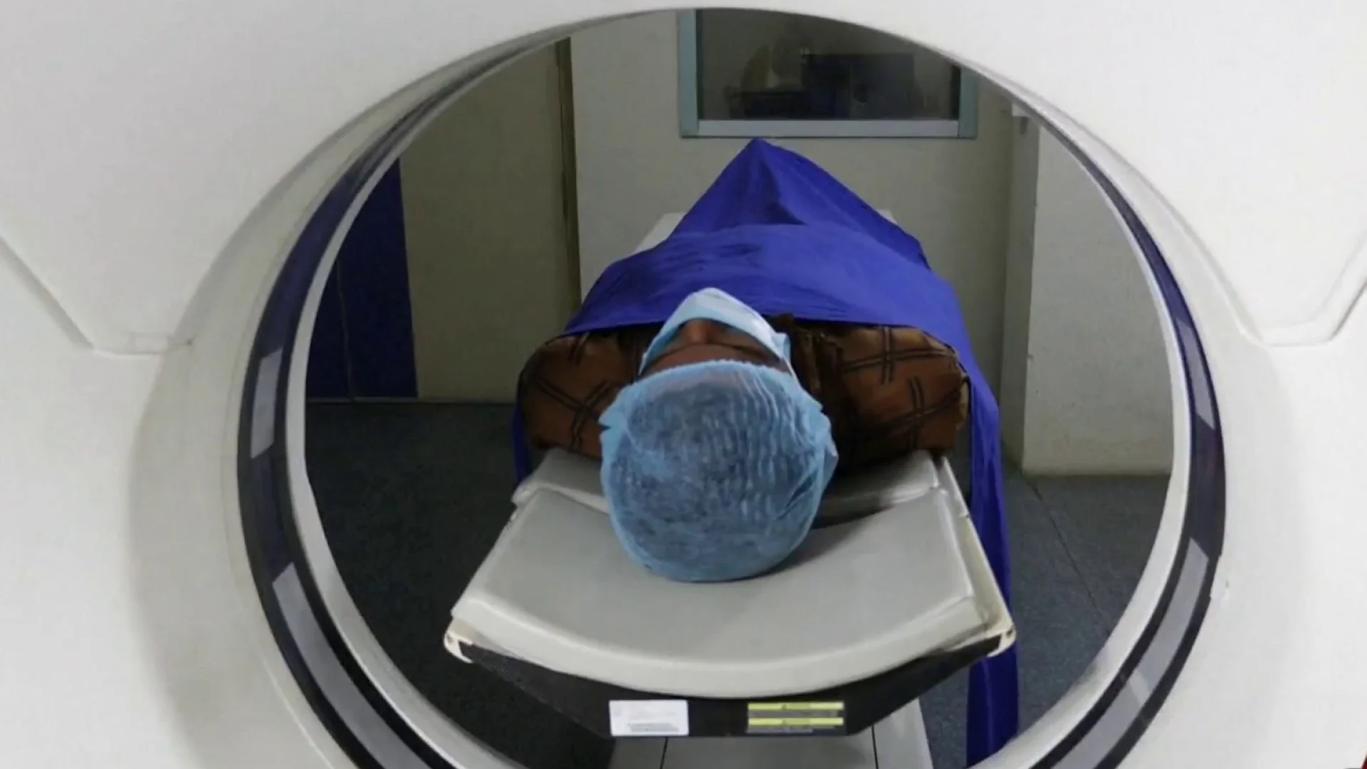 Featured image for Experts Advocate for Annual Lung Screenings to Combat Cancer