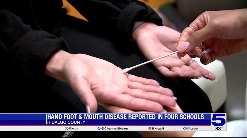 Featured image for Rising Hand, Foot and Mouth Disease Cases Spark Health Concerns in India and Cambodia