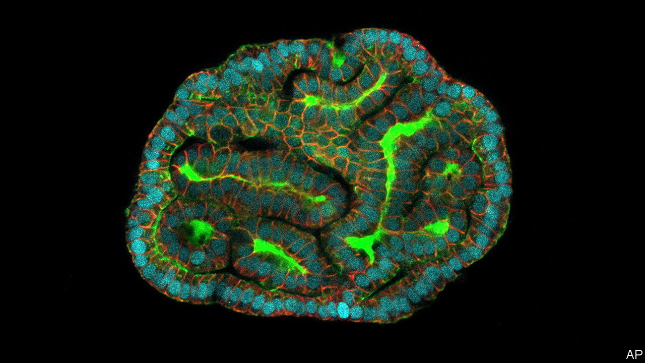 Featured image for "Growing Mini Organs from Fetal Cells: A Breakthrough in Personalized Medicine"