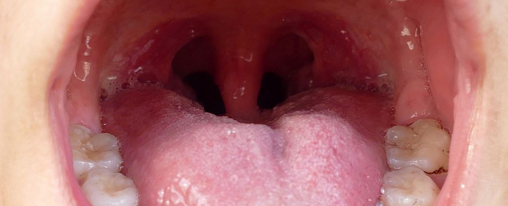 Featured image for New Research Links Mouth Bacteria to Heart Attack Risk