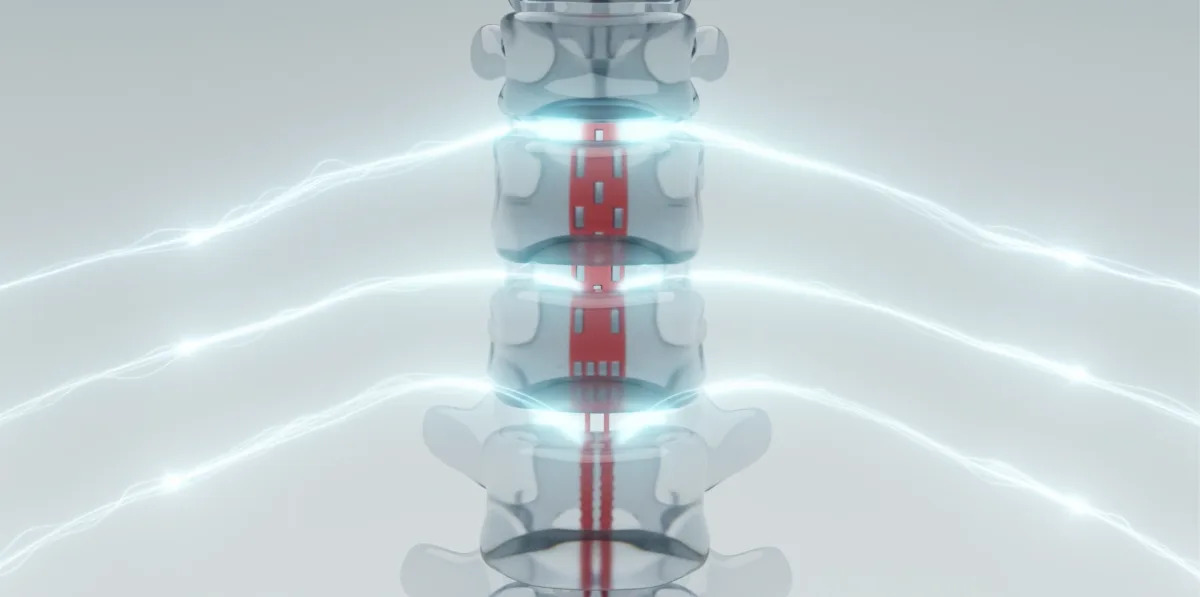 Revolutionary Nerve-Stimulation System Restores Arm Mobility for Quadriplegics