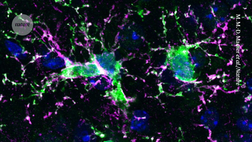 Featured image for Replacing Brain Immune Cells Shows Promise for Treating Neurodegenerative Diseases