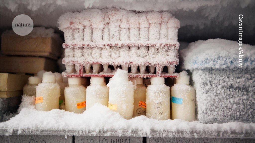 "Efficiently Organize Your -80°C Freezer for Time-Saving and Finger-Saving Benefits"