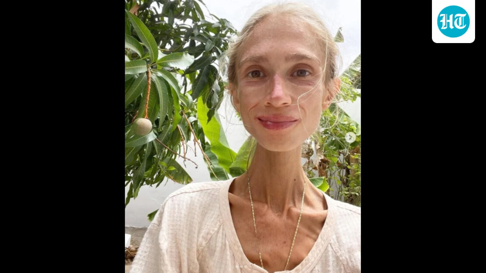 Featured image for Woman Dies of Starvation in Bali After Extreme Fruit-Only Diet