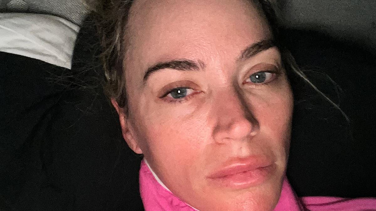 Teddi Mellencamp's Health Updates: Skin Cancer Treatment and Tamra Judge's Hospitalization