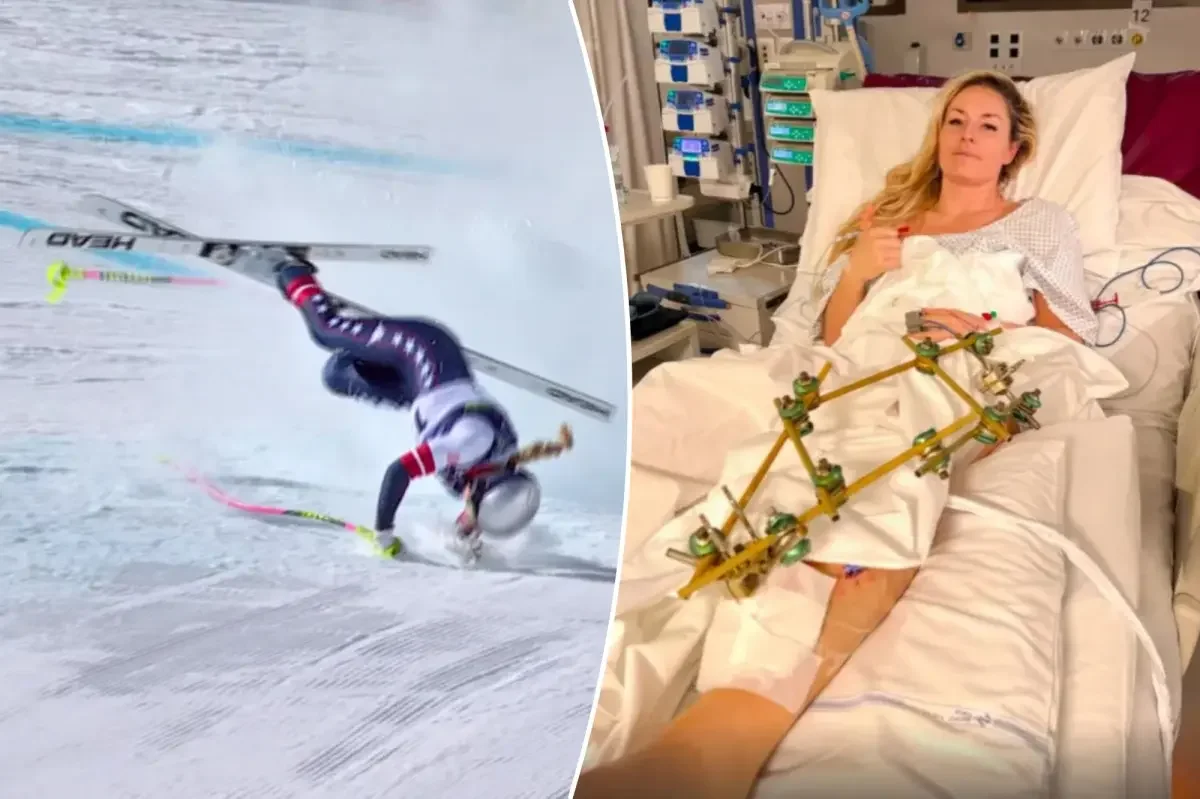 Vonn to head home for more surgeries after Olympic downhill crash