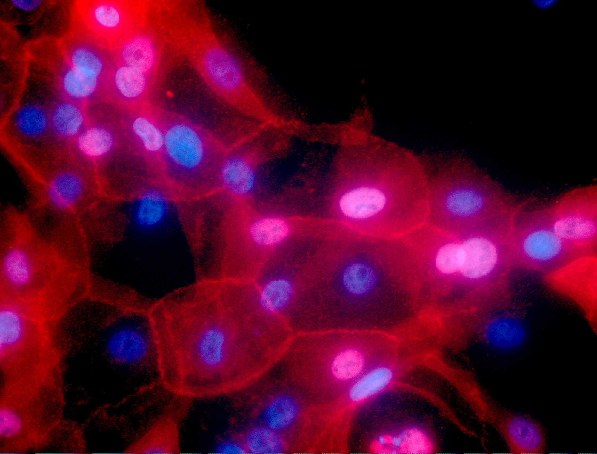 Featured image for Researchers identify method to eliminate dormant breast cancer cells and prevent recurrence