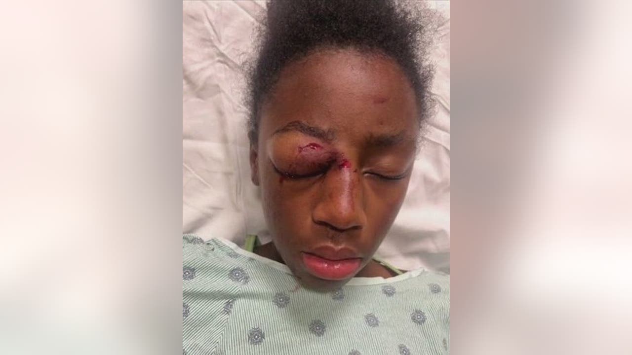 Featured image for Calls for Justice: 11-Year-Old Chicago Girl Brutally Beaten, Family Demands Answers