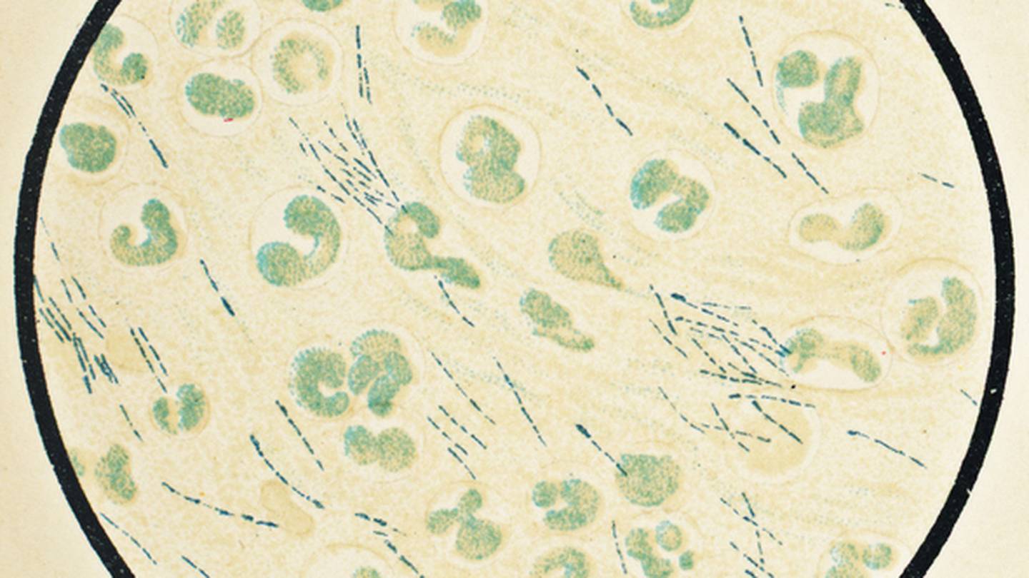 Rare, deadly bacteria discovered on U.S. Gulf Coast, warns CDC.