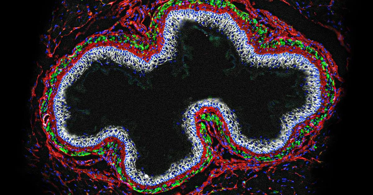 Featured image for "Unveiling the Role of Enteric Glia in Gut Health and Inflammation"