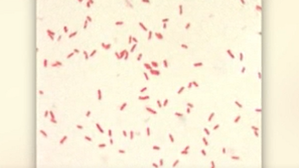 Featured image for "Fatal Plague Case Confirmed in New Mexico"