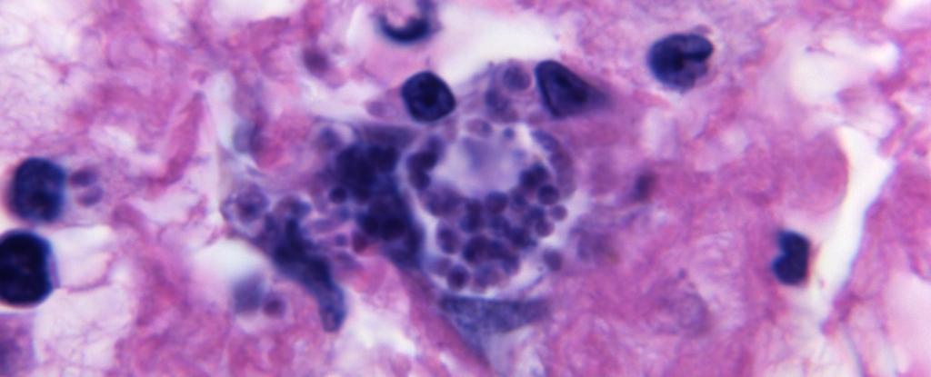 Featured image for Parasite Infecting 50% of People May Decapitate Human Sperm