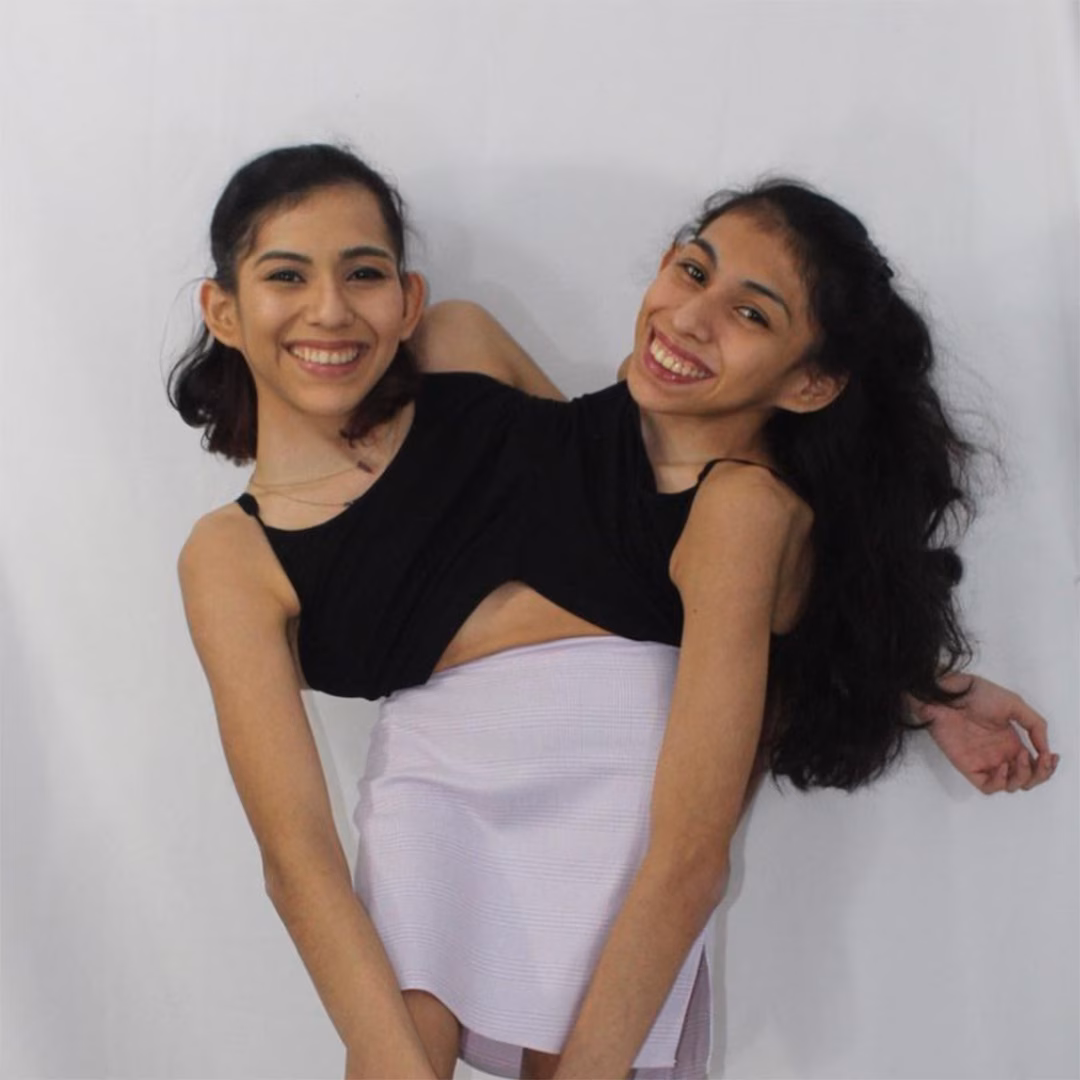 Featured image for Conjoined Twin Carmen Andrade Marries Boyfriend Daniel McCormack in Elopement